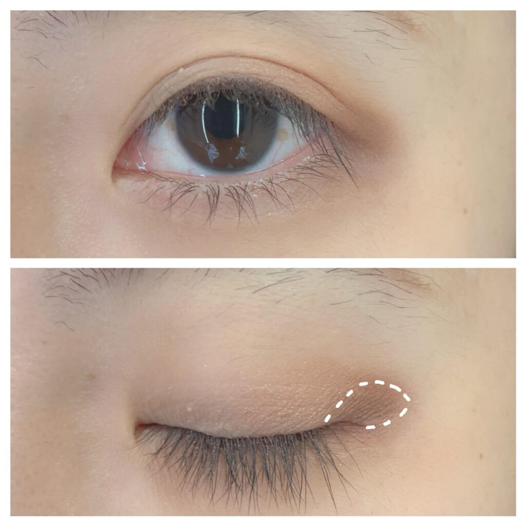 目尻キワに締め色⑥を入れた状態。面長解消メイク手順。